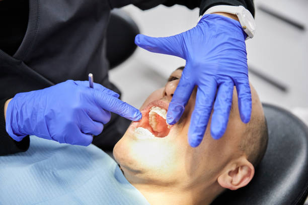 Best Emergency Tooth Extraction in Brimfield, OH